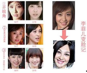 杭州整容爆料事件真相视频