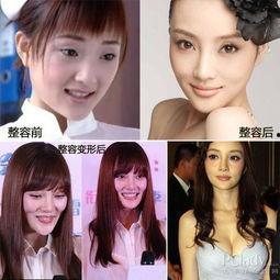 杭州整容爆料事件真相视频  第2张