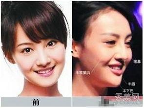 杭州整容爆料事件真相视频  第3张